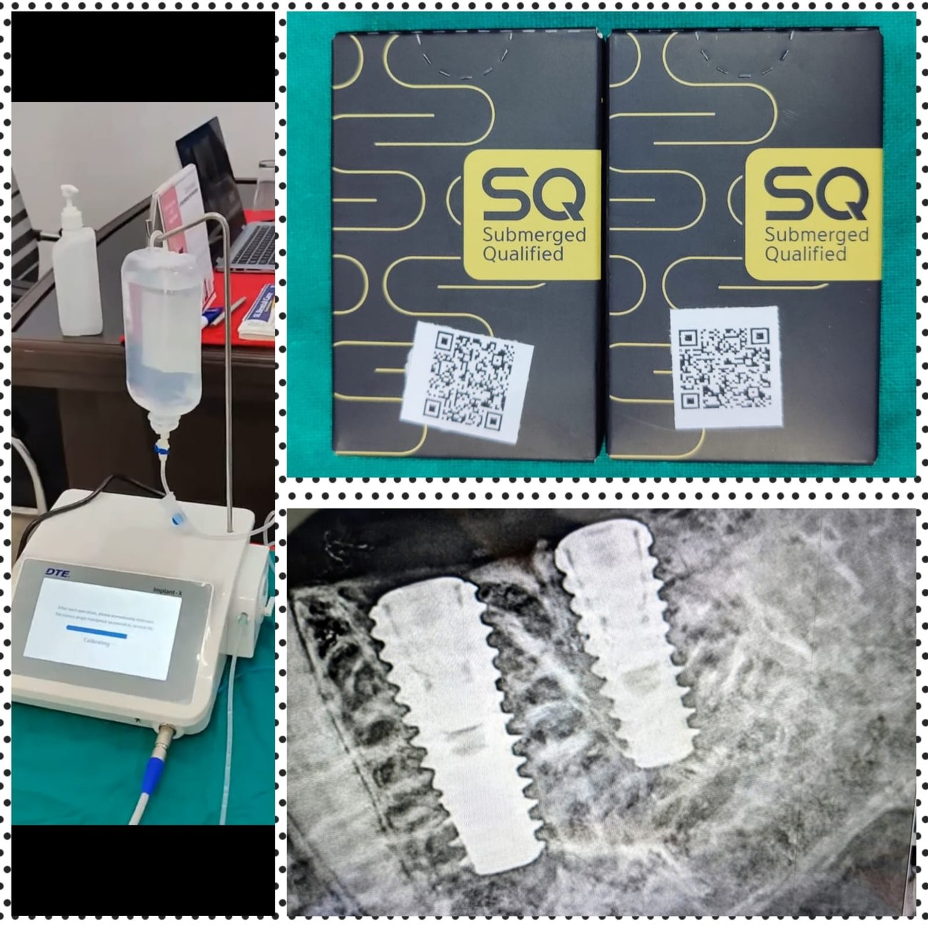 Quality-certified dental implants and precision instruments