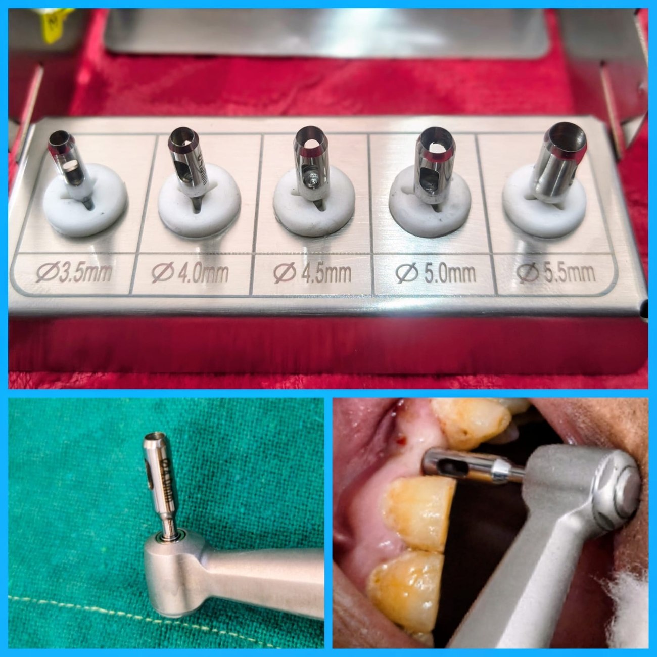 Implant kit and surgical instruments