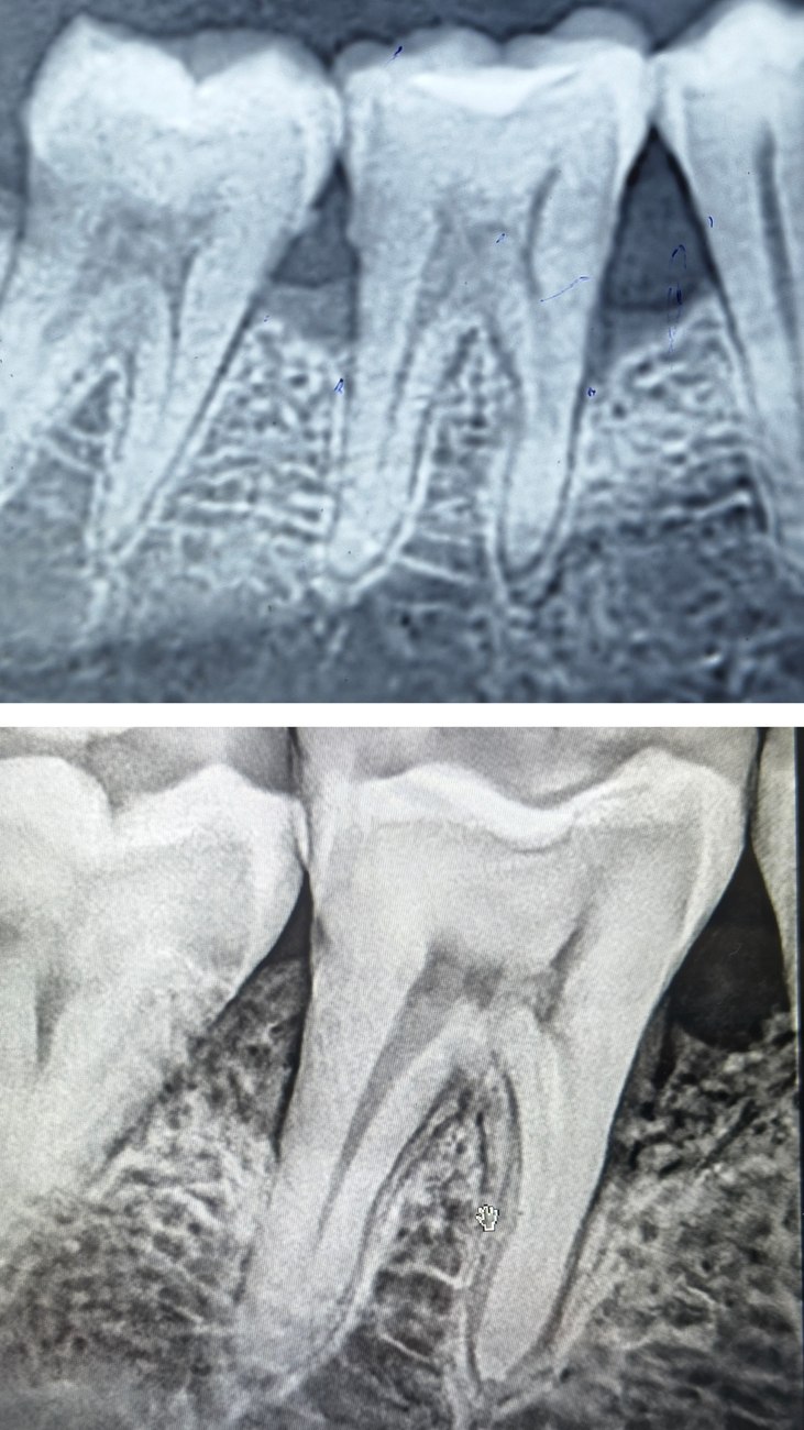Diagnostic dental X-ray imaging