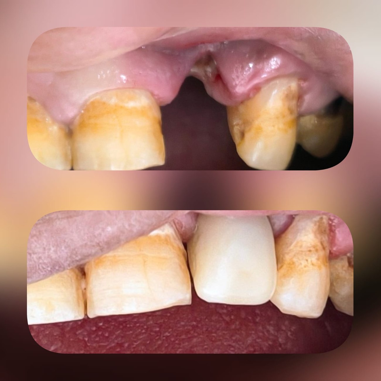 Patient results before and after treatment