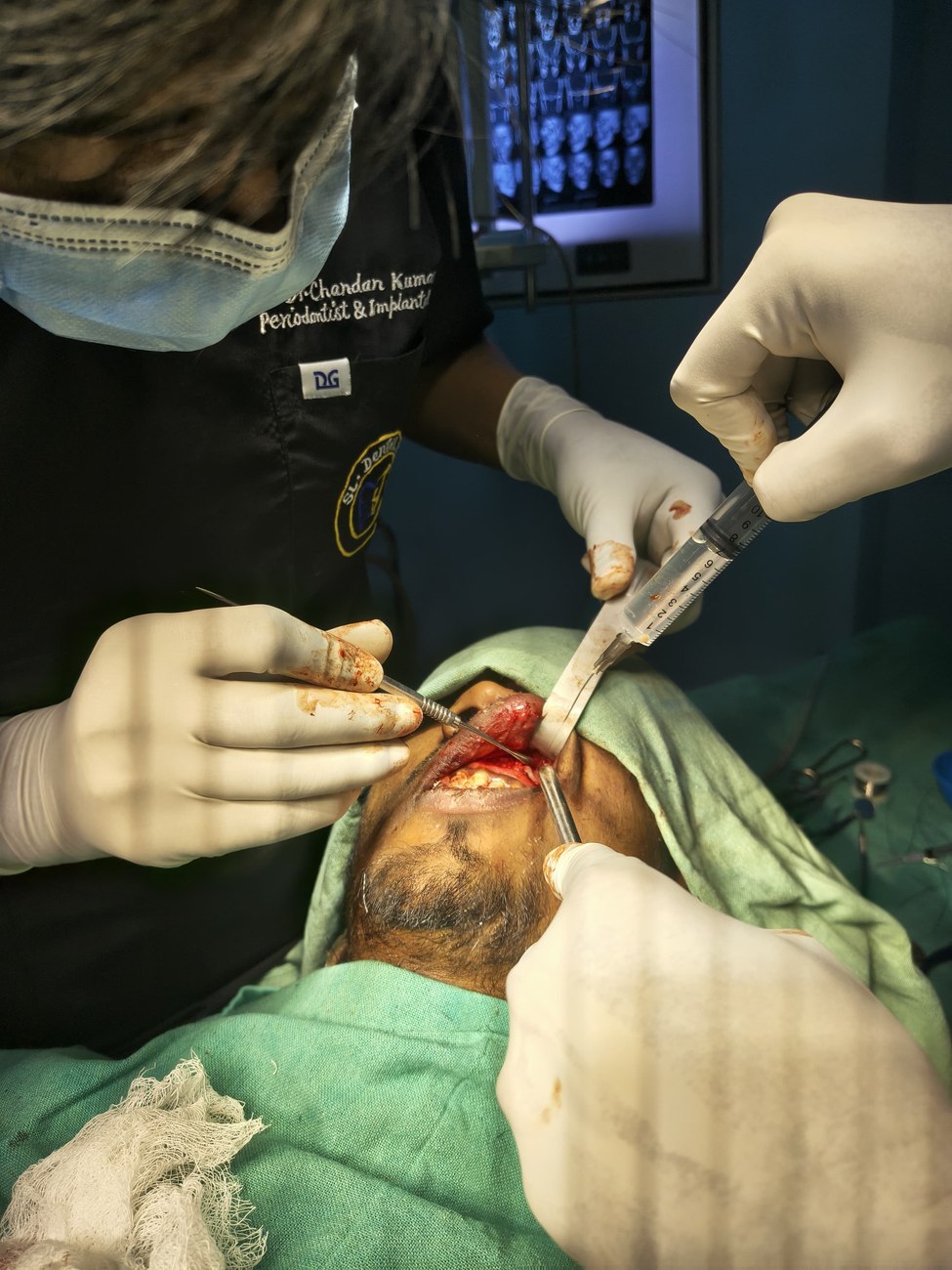 Dr. Chandan Kumar performing oral surgery